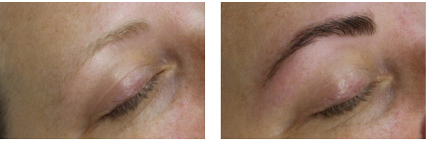 cropped image focused on eye and eyebrow, before and after