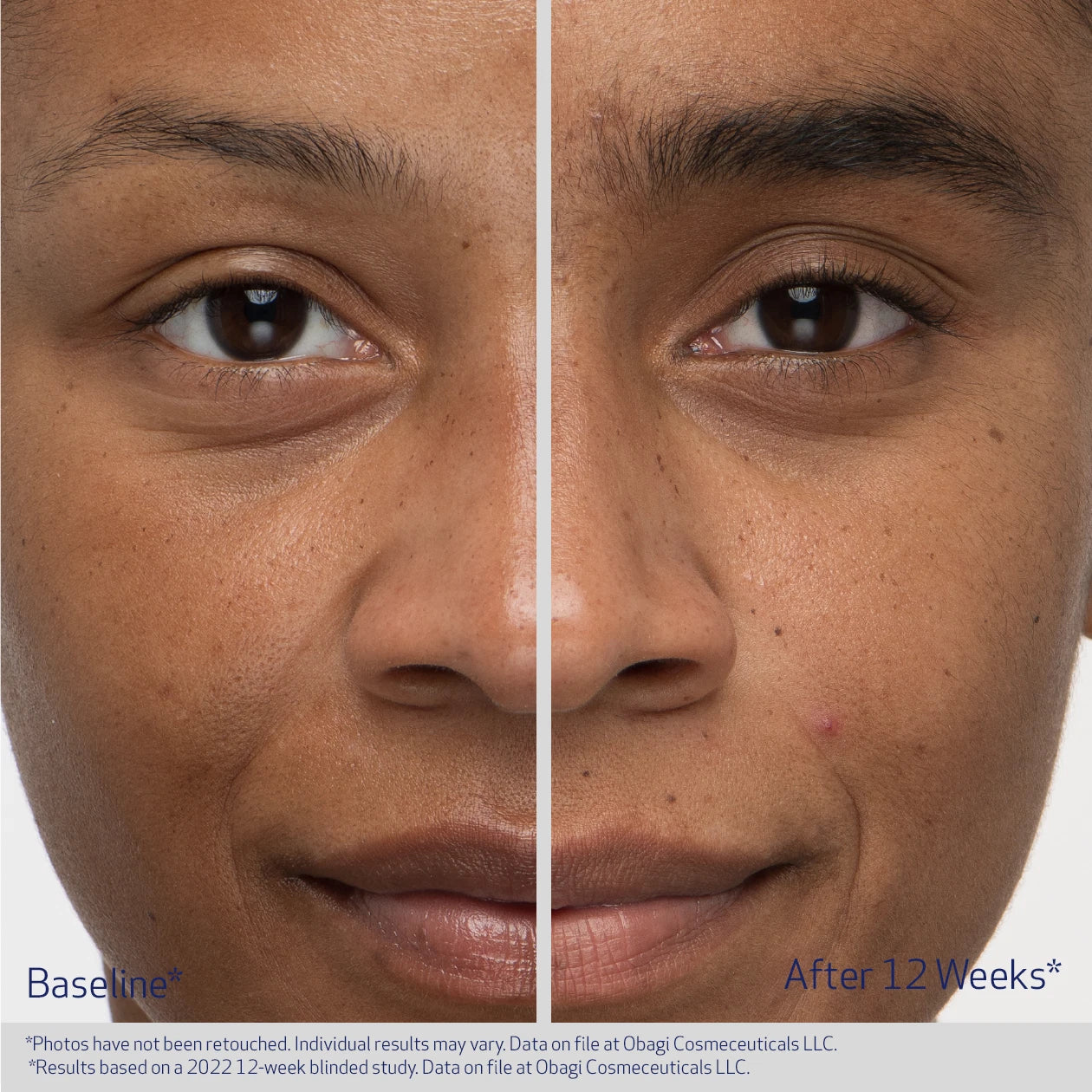 Obagi Nu-Cil™ Eyebrow Boosting Serum - Image 5