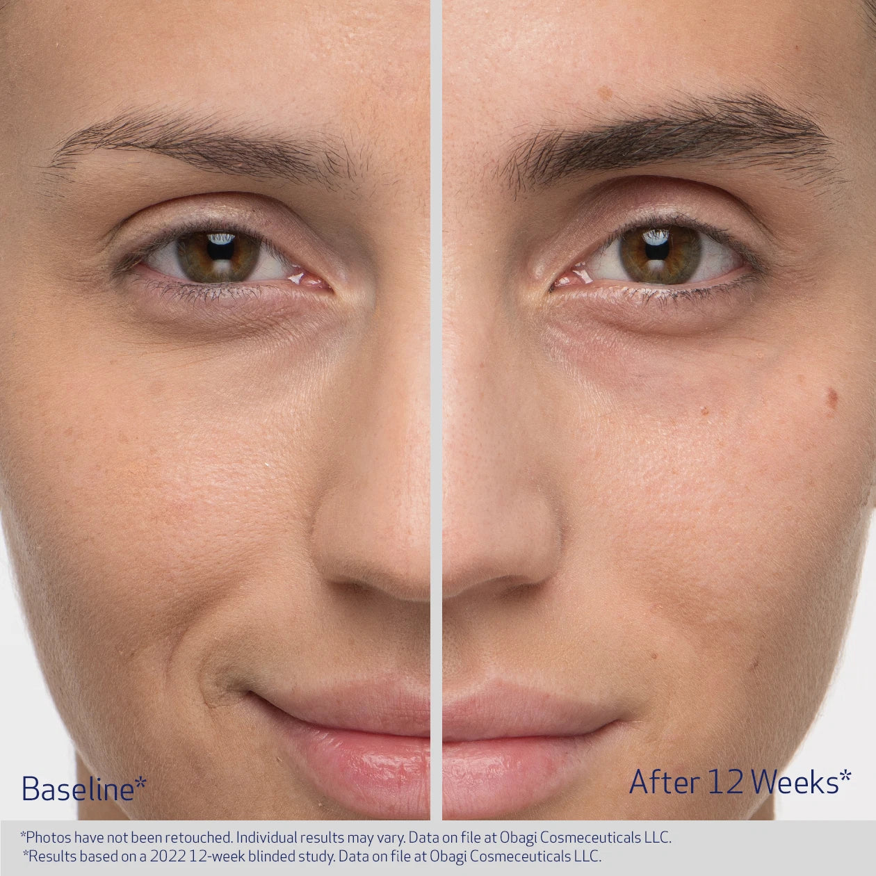 Obagi Nu-Cil™ Eyebrow Boosting Serum - Image 4